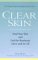 Clear Skin: Heal Your Skin and End the Breakouts- Once and for All